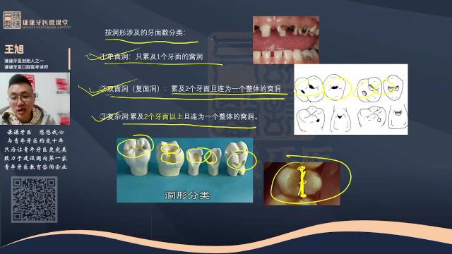 谦谦牙医2023年口腔执业(助理)医师考试——牙体牙髓