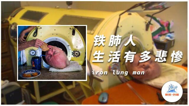 铁肺人的生活到底有多悲惨?全身只有脑袋能动,断电就等于死亡