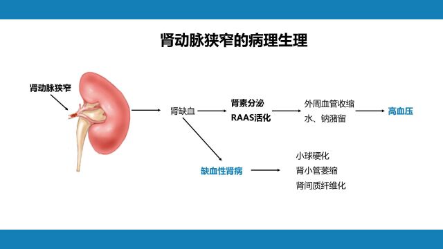 肾血管疾病,泌尿系统疾病PPT