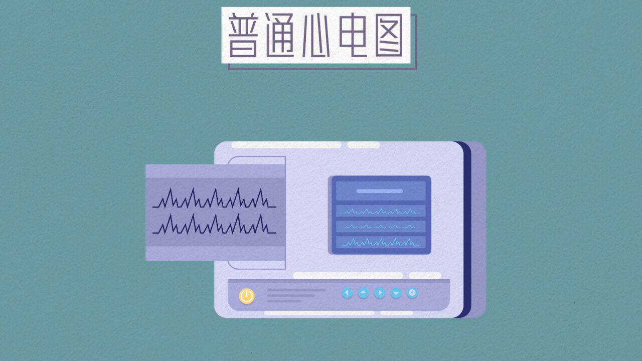 怎么检测是否心梗 f3502jkwezo_hz.jpg