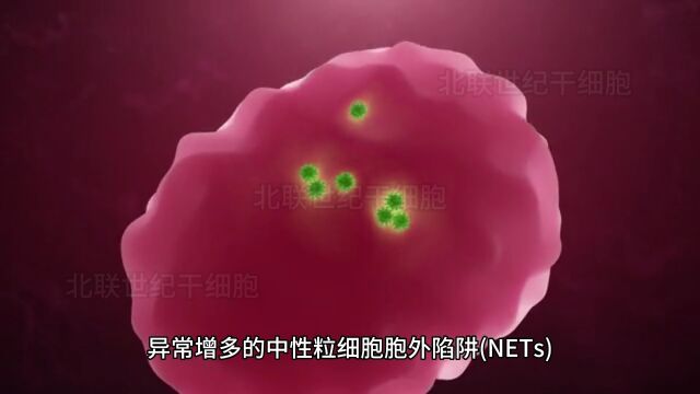 干细胞新资讯,糖尿病、恶性肿瘤有新突破