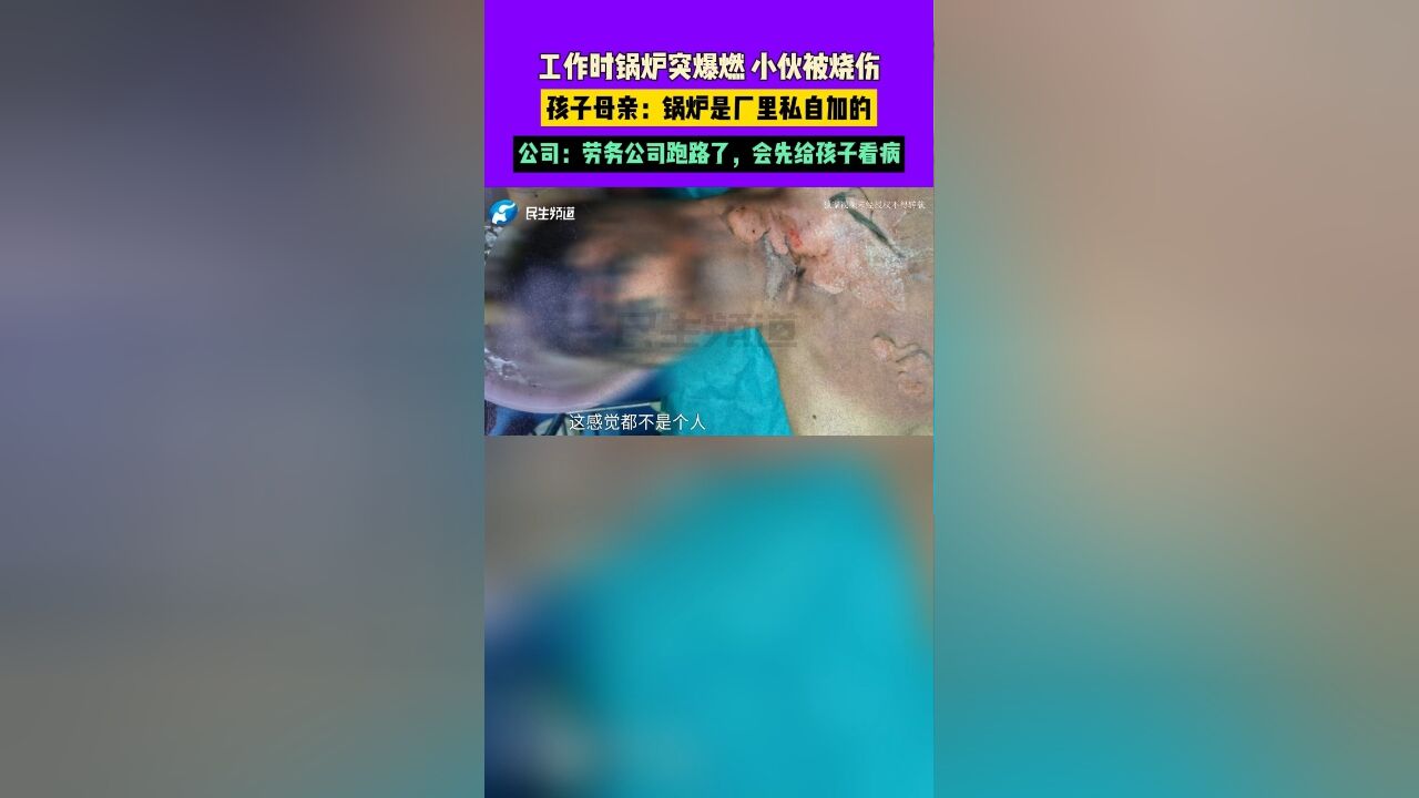 工作时锅炉突爆燃,小伙被烧伤,孩子母亲:锅炉是厂里私自加的,公司:劳务公司跑路了,会先给孩子看病