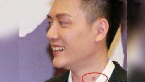 这些明星带着吻痕出席公开活动，被采访时还装不知道 - 腾讯视频