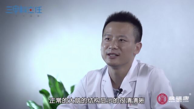 脑磁共振主要检查什么?