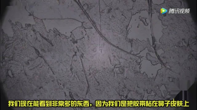 显微镜下放大螨虫2000倍,感觉就像找到了史前生物一样