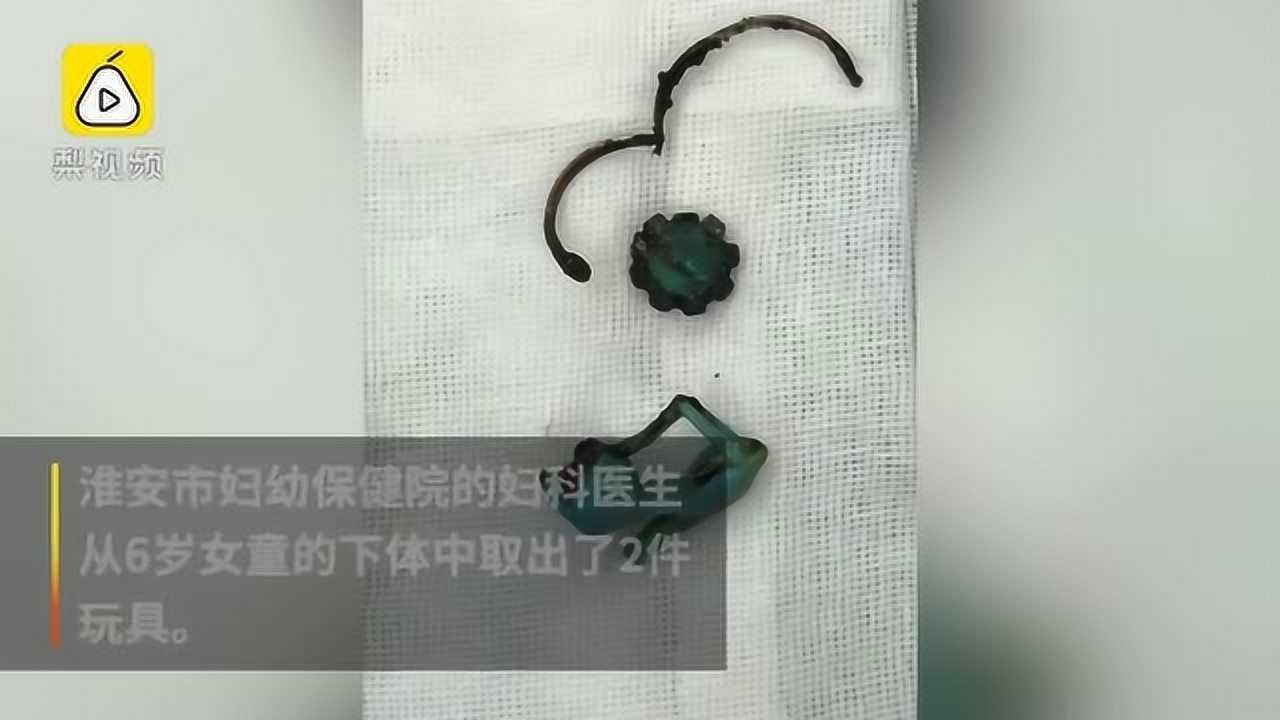 6岁女童下体被塞入2件玩具 家长1年后才发现