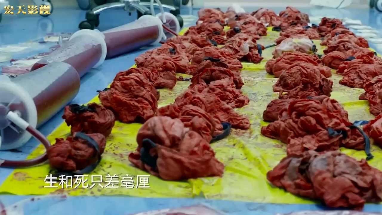 人间世孕妇剖腹产大出血止血纱布铺了一地做母亲真不容易