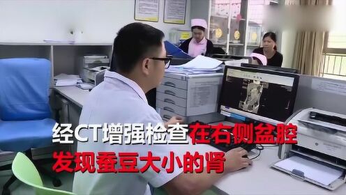 【腾讯视频】 6岁小女孩尿裤子4年，一查发现右肾不见了