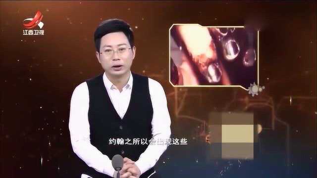 男子被跳蚤咬一口竟感染可怕黑死病,瞬间席卷全球2亿人因此丧生