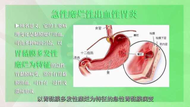 胃炎的概念和分类