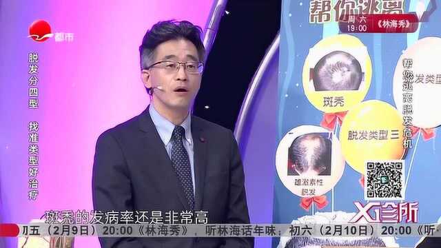 斑秃也会引起脱发?专家现场解答:只需治愈就能重返一头秀发