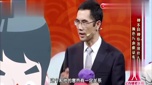 养生堂:小心你舌下脉络变粗了,专家:是你血瘀了会有大危害