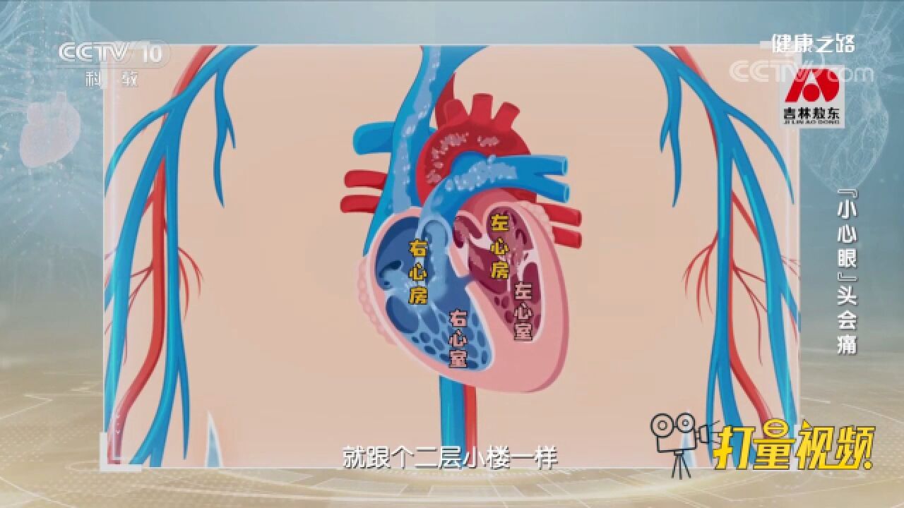 头痛、眼花等生活中常见的“小毛病”,可能和卵圆孔未闭有关