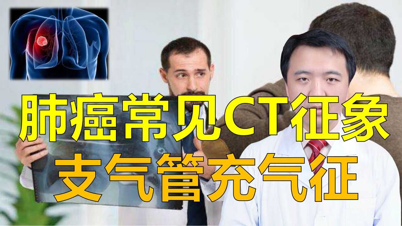 肺癌常见CT征象,支气管充气征,听闫晓亮博士详细解读