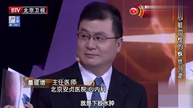 两张图片吓坏观众,专家却一脸淡定,为何观众反应如此巨大?