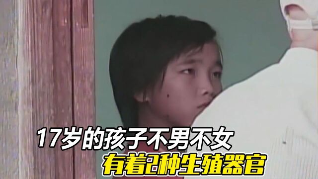 17岁的孩子不男不女,有着2种生殖器官,医生也琢磨不定