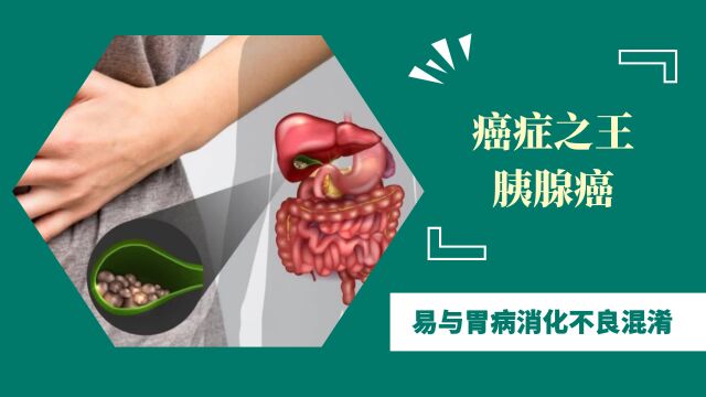 癌症之王胰腺癌,易与胃病消化不良混淆,出现3个症状,及时就医