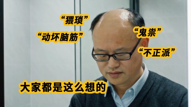 男子苦受脱发困扰选择戴假发:不想被认为是坏人!