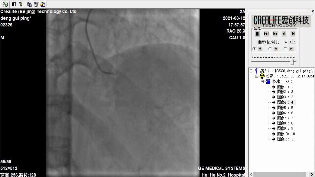 心脏造影图像4