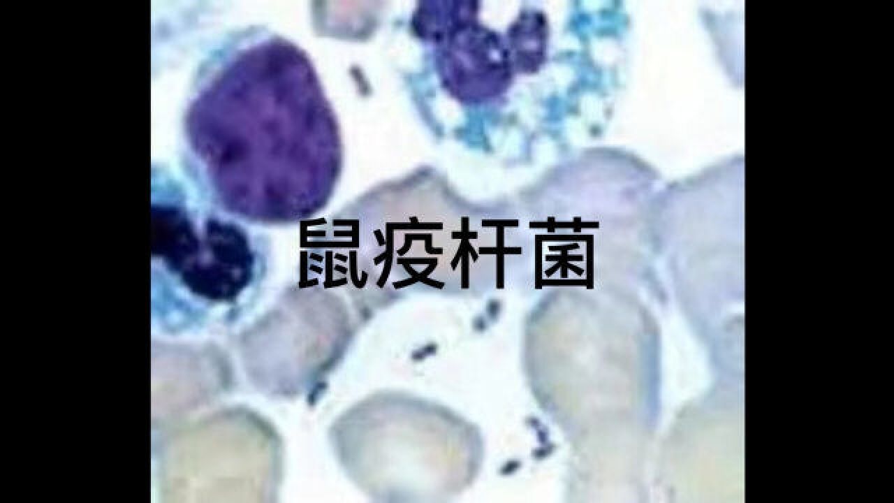 鼠疫为何还是甲类传染病?了解现实与影视中的黑死病