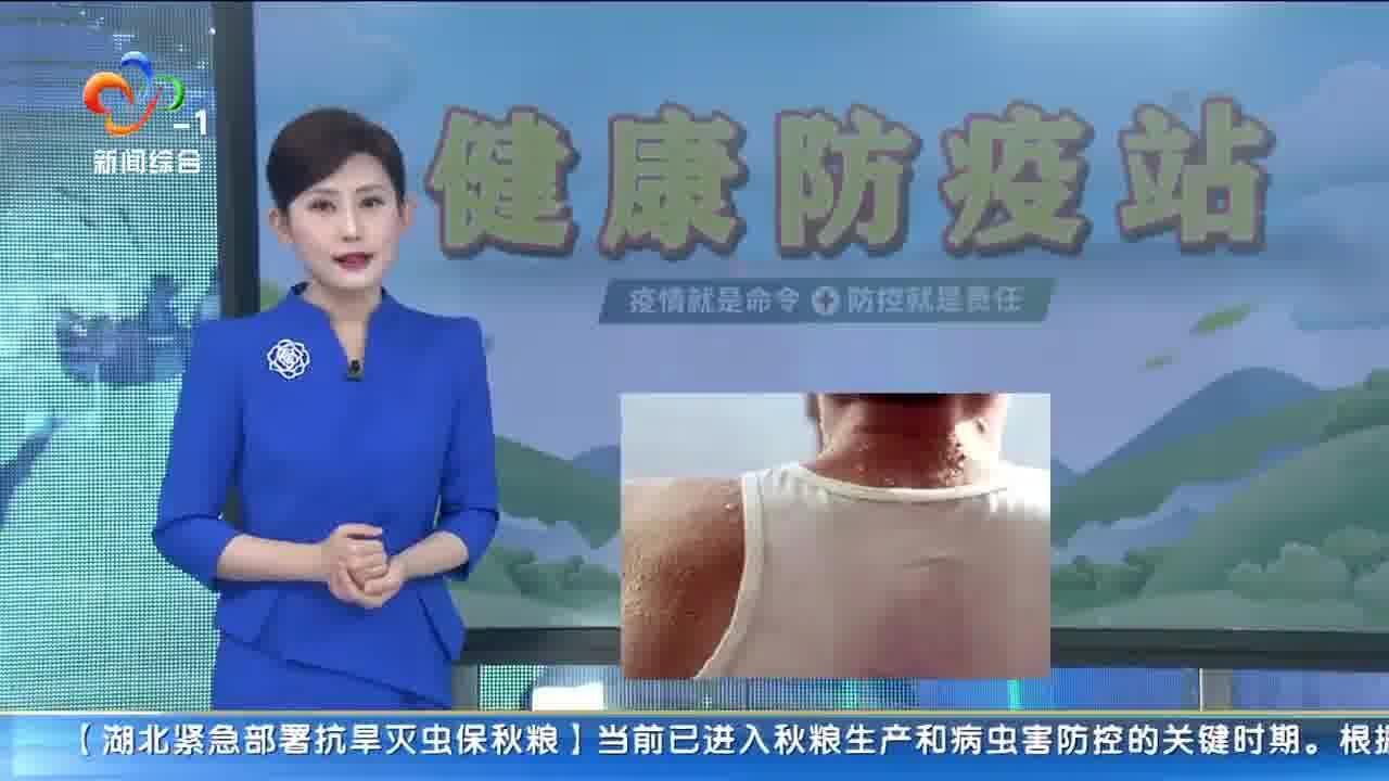 健康防疫站:人每天出汗量多少算正常?