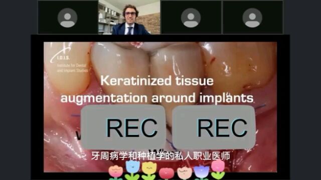 IDIS《种植体周围软组织移植技术》线上课程第一小节
