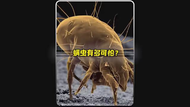 螨虫有多可怕?教你一招有效除螨#科普 #螨虫 #涨知识