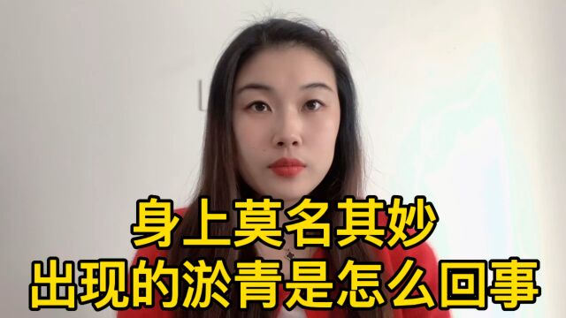 身上莫名其妙的淤青是怎么回事?