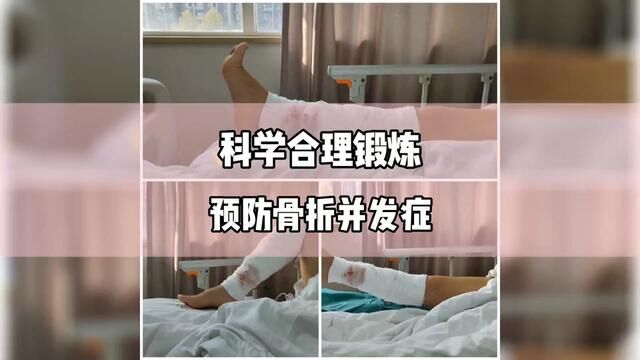 科学合理锻炼预防骨折并发症.#骨折 #骨科郭前进医生