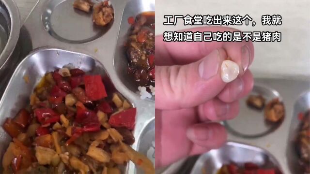 男子称在工厂食堂疑似吃到牙齿:反馈后公司称是骨头类的东西