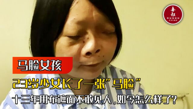 23岁少女长了一张马脸!13年用布遮面不敢见人,如今她过得怎样