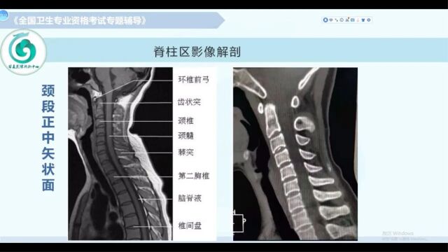 【放射医学(中级)】第七章影像解剖:神经系统(下)2