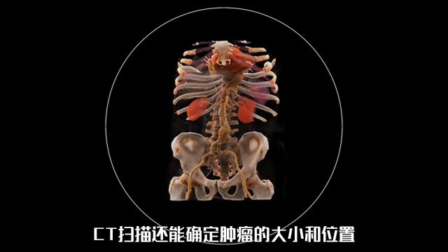 什么是计算机断层扫描? CT 是如果检查身体部位的?