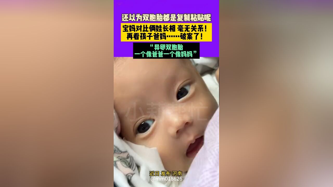 近日 发布 河南 还以为双胞胎都是复制粘贴呢!宝妈对比俩娃长相 毫无关系!再看孩子爸妈……破案了!“异卵双胞胎 一个像爸爸一个像妈妈”