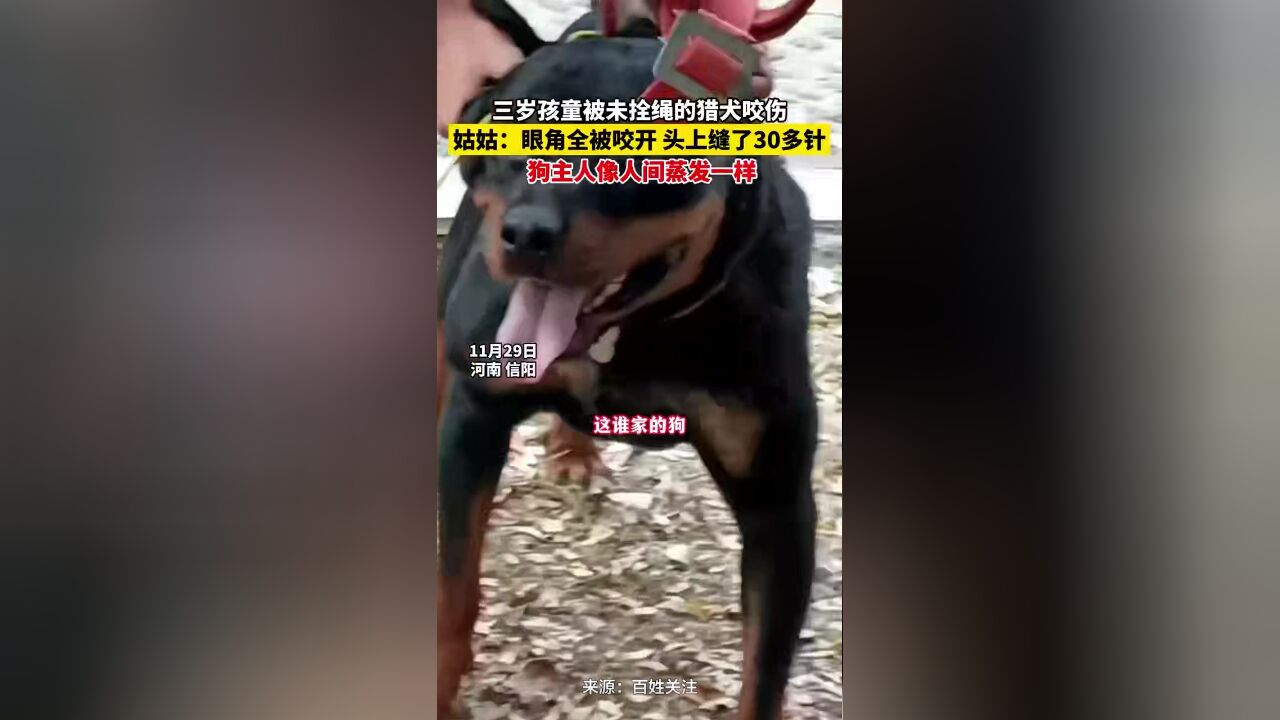 三岁孩童被未拴绳的猎犬咬伤,姑姑:狗主人像人间蒸发一样