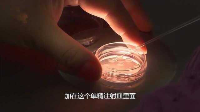 实拍体外精卵结合全过程!精子真的长得像小蝌蚪