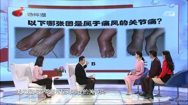 通过3张图片帮你区分,痛风类风湿关节炎和反应性关节炎的区别!