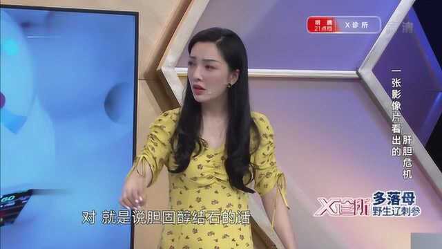 胆囊究竟有什么作用,这样的解释你记住了没