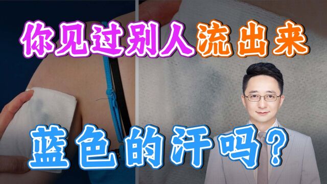 少女衣服被汗染蓝,色汗症是什么?我们需要注意些什么