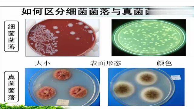 细菌和真菌培养的方法,最全面的讲解!快来看看吧