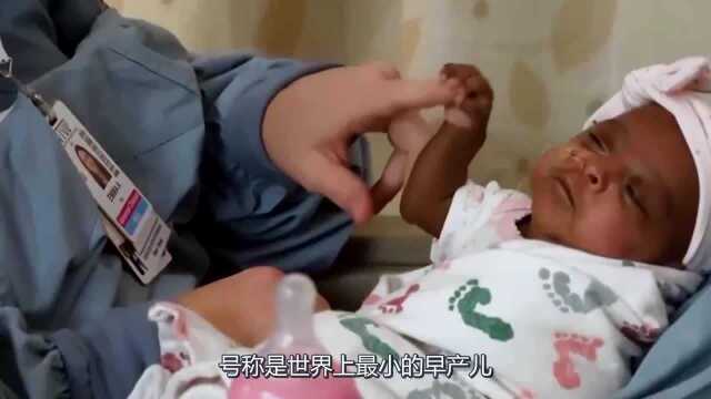 世界上最小的婴儿,把蛋壳当成“摇篮”,如今变成什么样子了?