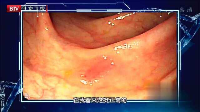 老者结直肠癌8年治愈,专家告诉你增加治愈可能的救命方,新技术