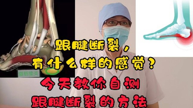 跟腱断裂有什么样的感觉 ?今天教你自测跟腱断裂的方法