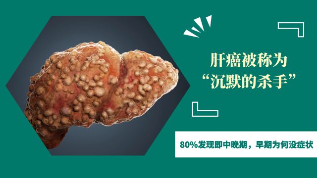 肝癌被称为“沉默的杀手”,80%发现即中晚期,早期为何没症状?