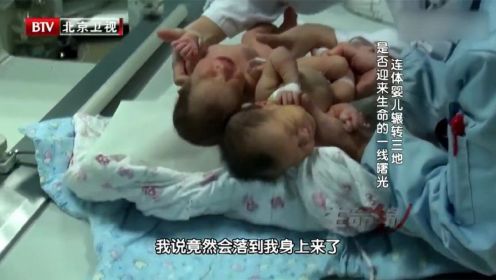 生命缘：夫妻求子七年，惊喜怀上双胞胎，竟产下连体婴儿