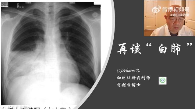 @寒江独钓僧(江博士):再谈“白肺”