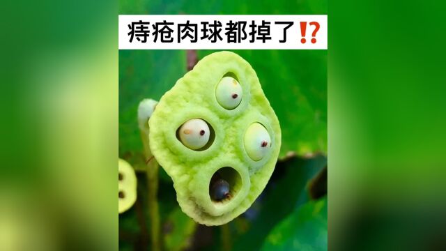 痔疮病差点把我折腾“没了”!幸好找到治愈秘诀!