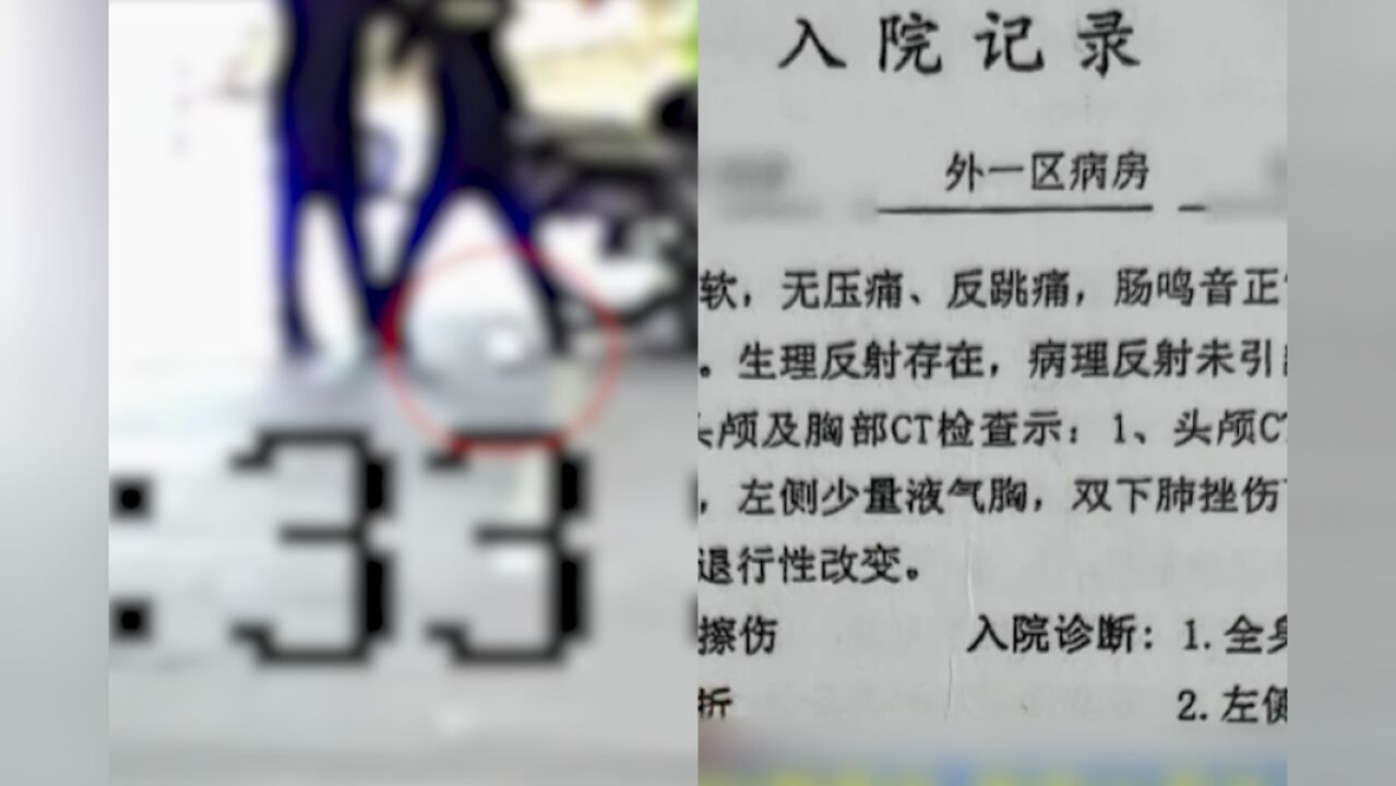 与同事互殴致伤被认定工伤,公司不服起诉,法院:撤销,互殴受伤不属于工伤