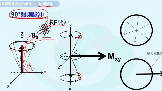 【放射医学(中级)】第四章磁共振成像基础(二)