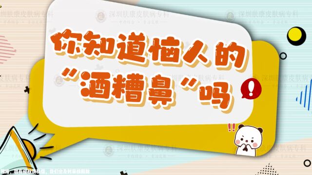 【肤康 科普】你知道恼人的“酒糟鼻”吗?| 深圳治酒糟鼻去哪个皮肤科